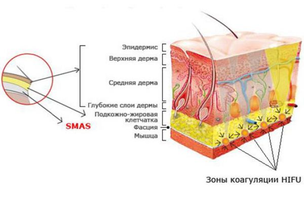Что такое слой смас?