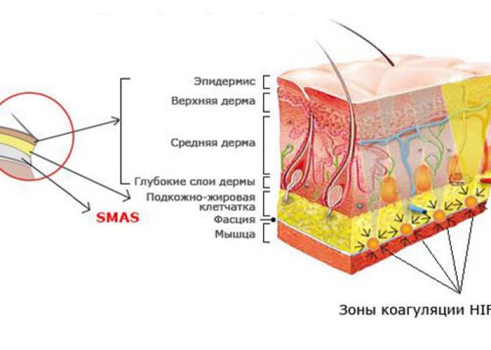 Что такое слой смас?